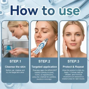 𝐎𝐟𝐟𝐢𝐜𝐢𝐚𝐥 𝐁𝐫𝐚𝐧𝐝 𝐒𝐭𝐨𝐫𝐞 |✅🎉MRAVION® 7-𝐷𝑎𝑦 𝗧𝐚𝐠 & 𝗦𝗽𝐨𝐭 𝐄𝐫𝒂𝒔𝒆𝒓(Zero Pain, Zero 𝐒𝐜𝐚𝒓𝒔 Rollerball)