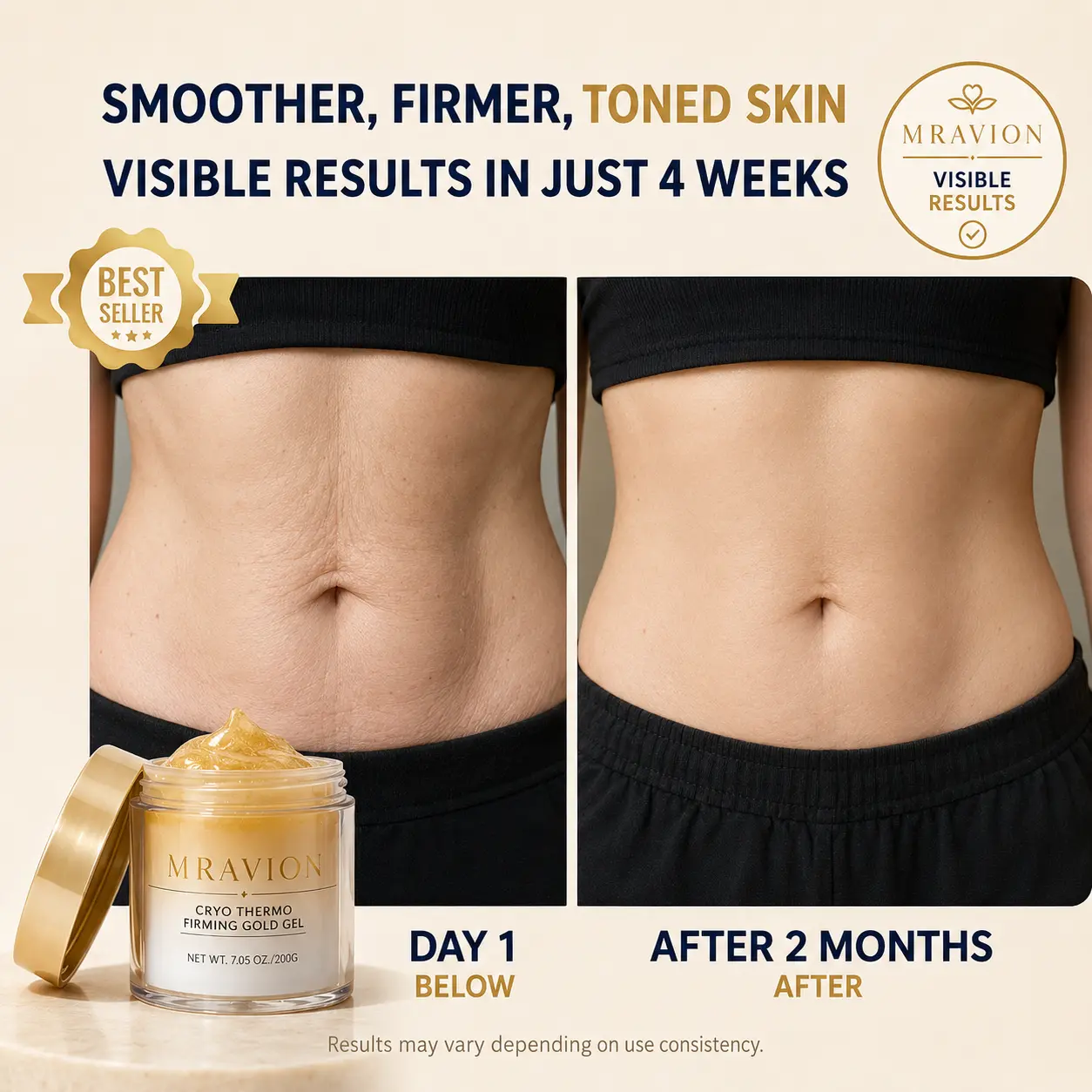 MRAVION™ Anti-Cellulite Body Cream