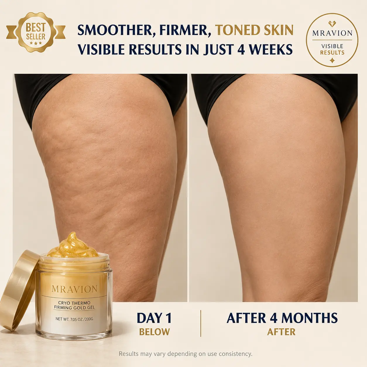 MRAVION™ Anti-Cellulite Body Cream